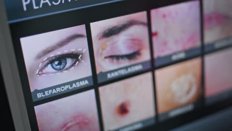 Cosmetologist-working-monitor-equipment-choosing-rejuvenation-procedure-close-up