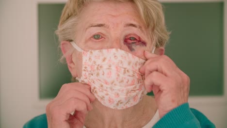 Mujer-Anciana-Angustiada-Con-Ojo-Morado-Usando-Máscara-Facial-Concepto-De-Alto-Riesgo