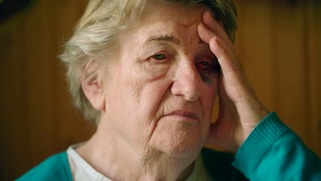 Mujer-Anciana-Con-Expresión-De-Preocupación-Sosteniendo-La-Mano-Cerca-Del-Daño-Por-Traumatismo-Ocular-Negro