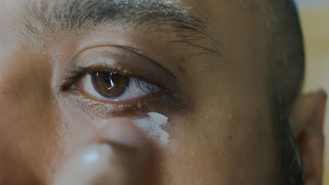 Südostasiatischer-Indischer-Mann,-Der-Vitiligo-Um-Das-Augenlid-überprüft