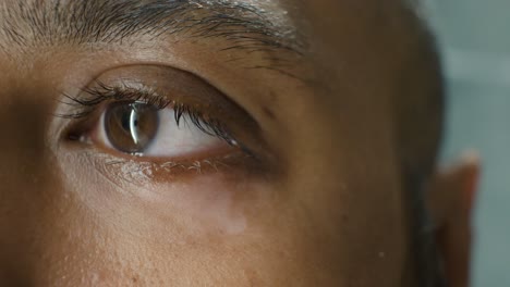 Nahaufnahme-Von-Vitiligo-Auf-Dem-Augenlid-Eines-Südostindischen-Mannes