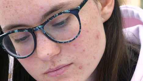 Young-girl-with-glasses-and-the-face-covered-in-acne-looks-down,-feeling-shame