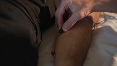Doctor-Applying-Electrode-Clamps-to-Needles-on-Patient-Arm-During-Electroacupuncture-Session