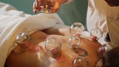 Therapist-Applying-and-Removing-Cupping-Suction-Cups-to-Patients-Back