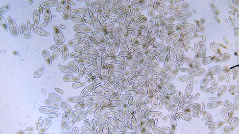 Alta-Densidad-De-Protozoos-Paramecium-Unicelulares-Bajo-El-Microscopio