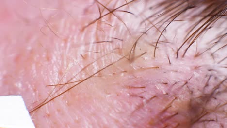 4K-Super-macro-shot-of-hair-removal-with-tweezers,-on-a-caucasian-person,-at-an-extreme-close-up,-in-a-studio