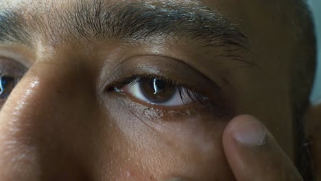 Südostasiatischer-Indischer-Mann,-Der-Nach-Vitiligo-Um-Die-Augenlider-Sucht