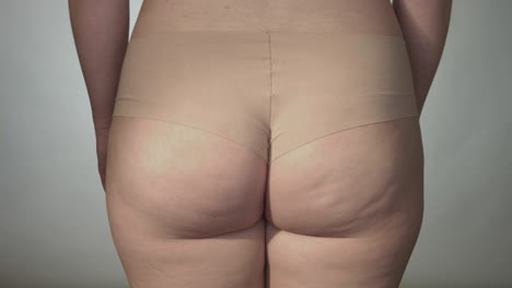 Close-up-on-woman-buttocks-with-cellulite
