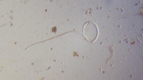 Nematodenparasitischer-Wurm-Im-Hellfeld-Des-Mikroskops