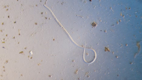 Nematodenparasitischer-Wurm-Im-Hellfeld-Des-Mikroskops