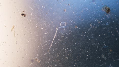 Nematode-parasitic-worm-in-microscope-bright-field