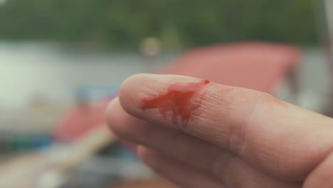 Close-up-of-minor-cut-bleeding-on-young-man's-finger
