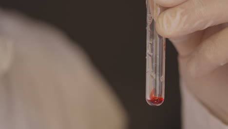 Closeup-macro-of-red-blood-specimen-in-a-tube