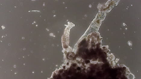 A-microscopic-rotifer-filter-feeds-and-retracts-its-body