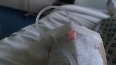 Close-up-of-a-patient's-bandaged-hand-with-an-IV-line-as-they-lay-in-a-hospital-bed