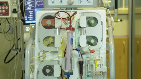 Dialysis-Machine-Being-Used-In-A-Hospital---close-up