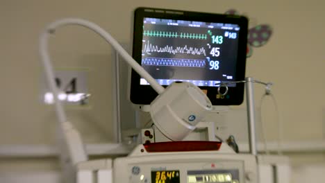 Vitalparameter-Monitor-In-Einem-Krankenzimmer---Rack-Fokus