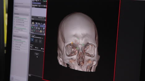 CT-Körperscan