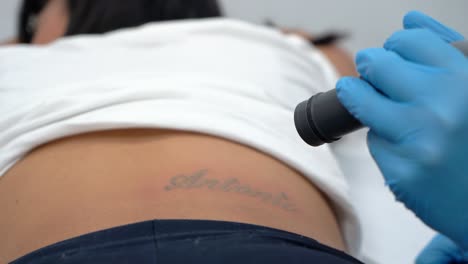 Girl-erasing-tattoo-of-exboyfriend-name,-deleting-or-removing