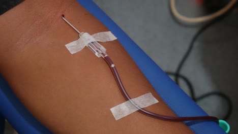 Close-up-shoot-of-arm-while-donating-blood-at-a-transfusion-center
