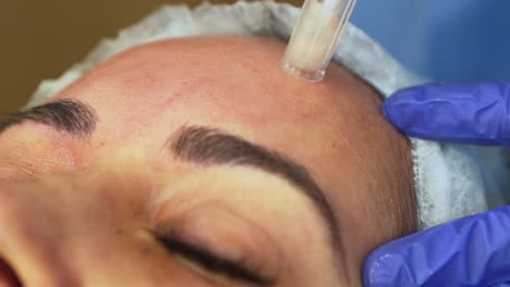 Schönheitsklinik,-Derma-Stift,-Nahaufnahme,-Gesichtsbehandlung,-Hautbehandlung,-Modell,-Kosmetik,-Gesichtsbehandlung,-Nahaufnahme-Haut,-Augenbrauen,-Stirn-Falten-Entfernen
