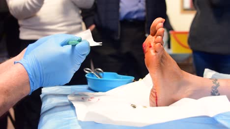 Ein-Chirurg-Oder-Podologe,-Der-Ein-Nadelverfahren-An-Der-Warze-An-Der-Fußsohle-Eines-Patienten-Durchführt