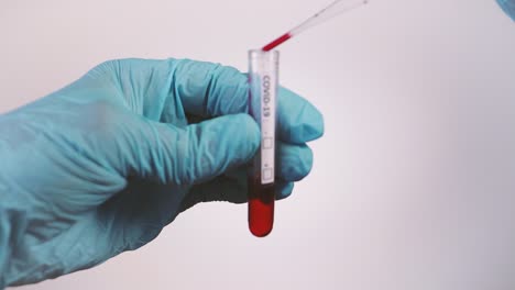 Gloved-hands-use-pipette-to-drop-blood-into-vial-for-covid-19-testing
