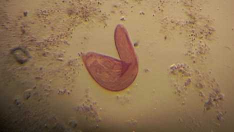 Microscopic-Blepharisma-move-about-using-cilia