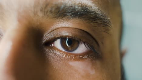Nahaufnahme-Von-Vitiligo-Am-Linken-Augenlid-Eines-Südostasiatischen-Mannes