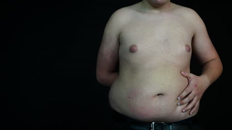 Zeitlupe-Eines-übergewichtigen-Mannes,-Der-Seinen-Dicken-Bauch-Schüttelt,-Schlechte-Ernährung-Und-Fettleibigkeitskonzept