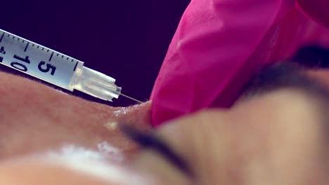 Close-up-of-a-woman-receiving-Botox-injection-treatment-therapy
