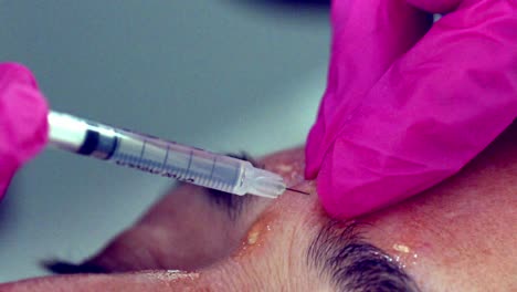 Close-up-slow-motion-of-a-woman-receiving-Botox-injections