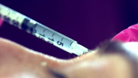 Close-up-of-a-woman-getting-Botox-injections-to-her-face