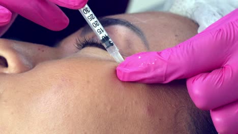 Hispanic-woman-getting-Botox-injection-around-her-eye
