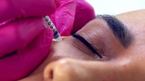 Hispanic-female-getting-Botox-injections---close-up