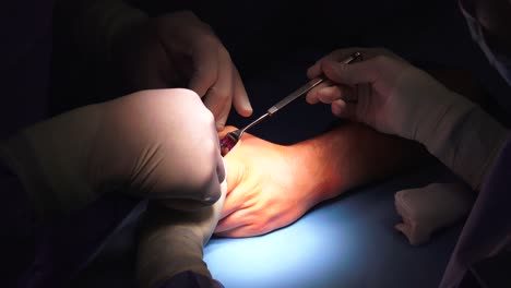 The-act-of-performing-surgery-may-be-called-a-surgical-procedure,-operation,-or-simply-"surgery