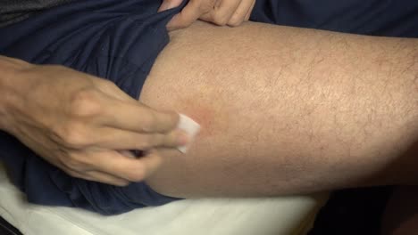 Alcohol-wipe-cleaning-subcutaneous-injection-site-upper-thigh