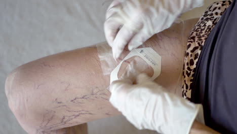 Middle-aged-woman-medical-patient-with-varicose-veins-applying-a-plastic-bandage-to-her-inner-thigh-during-an-at-home-antibiotic-infusion-treatment