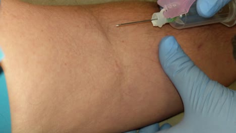 A-vien-being-checked-and-a-collection-needle-is-inserted-in-the-left-arm-of-a-patient