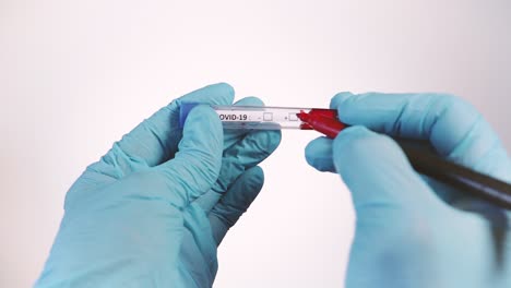 Covid-19-positive-result-on-blood-sample-in-test-tube