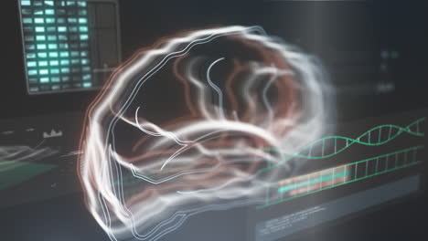 Medizinischer-Computerbildschirm-Mit-Tomographie-Des-Menschlichen-Gehirns