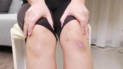 Woman-having-knee-pain-the-concept-of-preventing-leg-fatigue-and-self-massage