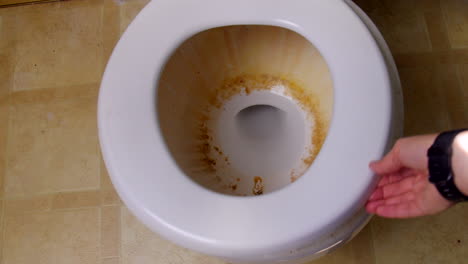 Dirty-toilet-bowl
