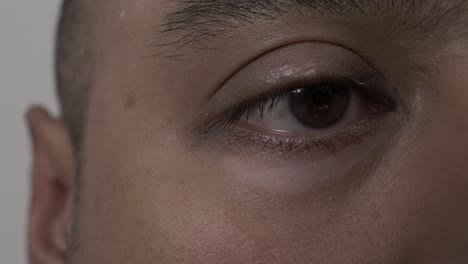 View-Of-Vitiligo-Underneath-Right-Eye-Of-Adult-Uk-Asian-Male