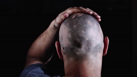 Hospital-patient-with-bald-head-in-chemotherapy-session,-rubbing-head-in-dark-room,-close-up