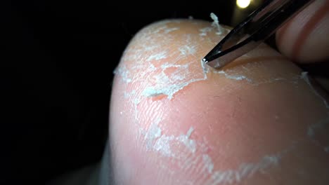 Close-up-video-of-foot-skin-exfoliation-2