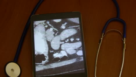 CT-Scan-Auf-Einem-Tablet-Zur-Diagnose