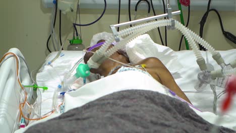Ein-Patient-Mit-Der-Brasilianischen-Variante-Von-Covid-19-P1-Hat-Schwierigkeiten-Beim-Atmen,-Während-Sein-Monitor-Einen-Warnenden-Alarm-Auslöst
