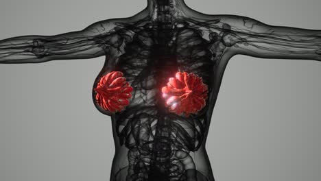 medical-scan-of-Woman-Breast-Cancer