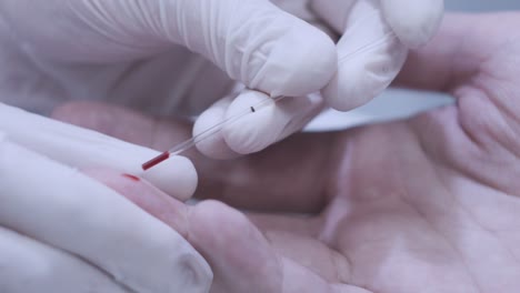 Doctor-hand-taking-blood-sample-for-medical-test.-Finger-blood-test